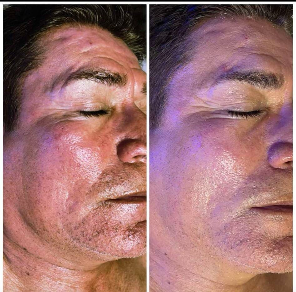 Celebrate Dad with a Gentlemen’s Facial at Evolve Tx Medical Spa